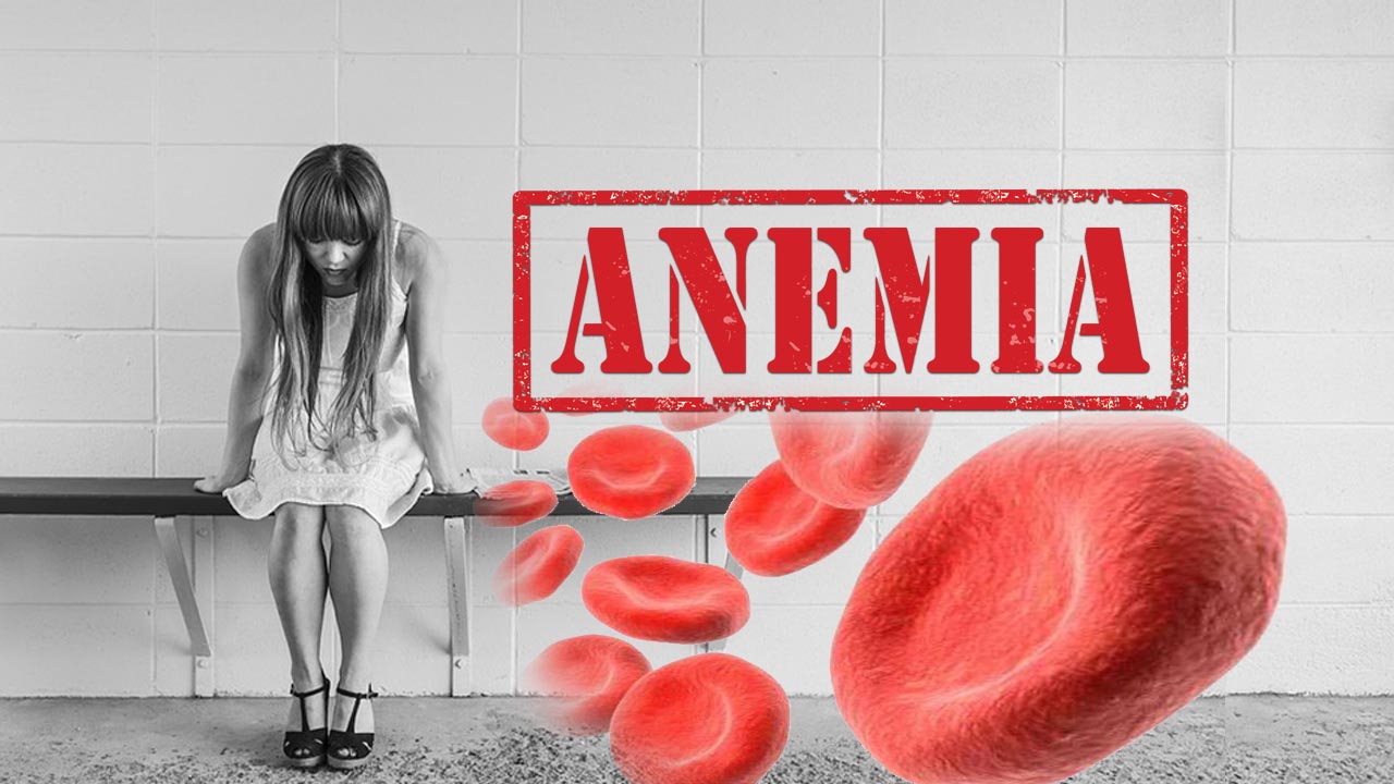 Pernahkah Anda melihat orang yang terlihat pucat, lemah, letih dan lesu  ? atau Anda sendiri pernah mengalaminya? Hal tersebut adalah tanda – tanda dari anemia dan biasanya tanda – tanda lainnya adalah Anda akan merasakan pusing, mudah lelah dan mual. Anemia adalah suatu kondisi dimana tubuh kekurangan hemoglobin yang terdapat di dalam  sel darah merah [&hellip;]