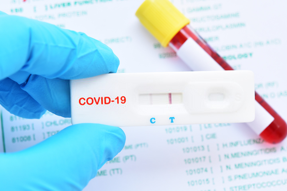 Maraknya pandemi COVID-19 yang masih belum mereda di Indonesia membuat masyarakat ingin mengecek status kesehatan mereka. Bahkan banyak yang membeli rapid test yang dijual online untuk melakukan tes secara mandiri. Apakah Sobat perlu melakukan rapid test secara mandiri? Bolehkah dilakukan sendiri? Baca Juga: Kenali Rapid Test dan Pembacaan Hasilnya Rapid test merupakan sebuah pemeriksaan skrining [&hellip;]