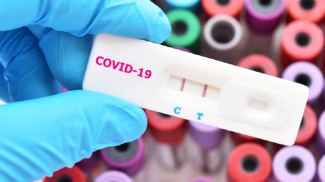 Belakangan ini tersiar kabar bahwa tes-tes Corona seperti rapid test dan PCR swab tidak lagi diperlukan dalam melakukan perjalanan, baik melalui darat, laut, dan udara. Dua metode tes ini memang sering dijadikan sebagai syarat supaya orang-orang yang melakukan perjalanan tersebut tidak menulari atau tertular virus penyebab Covid-19. Hal ini sudah tertuang dalam Keputusan Menteri Kesehatan Nomor HK.01.07/MENKES/413/2020 [&hellip;]
