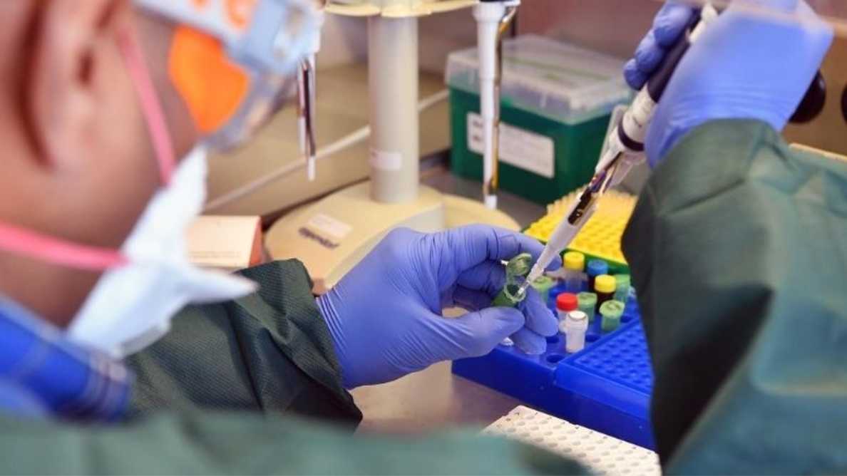 Tes Corona seperti rapid test dan PCR swab memang wajib dilakukan untuk mengindentifikasi positif atau tidaknya seseorang terinfeksi Covid-19. Namun ternyata bukan itu saja yang seharusnya dilaporkan, tetapi juga mengenai jumlah nilai cycle threshold atau CT yang mengindikasikan seberapa banyak virus yang tersimpan dalam tubuh seseorang yang sudah terinfeksi. Penerapan nilai CT dapat membantu dokter menandai pasien yang [&hellip;]