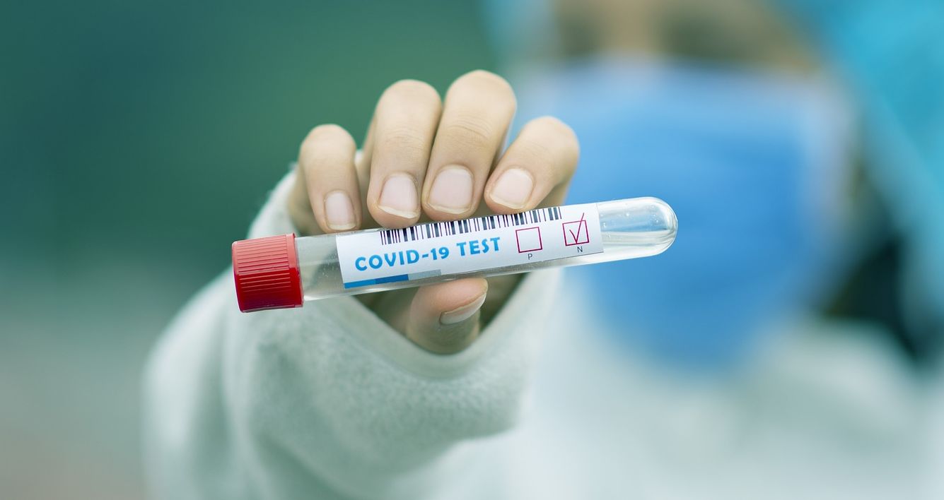 Satgas Covid-19 kembali mengeluarkan peraturan berupa Surat Edaran Nomor 1 Tahun 2021 Tentang Ketentuan Perjalanan Orang Dalam Negeri Dalam Masa Pandemi Coronavirus Disease 2019 (Covid-19). Surat edaran ini merupakan perpanjangan dari Surat Edaran Nomor 3 Tahun 2020 yang mengatur tentang peraturan perjalanan selama libur Natal 2020 dan Tahun Baru 2021 yang berakhir pada 8 Januari [&hellip;]